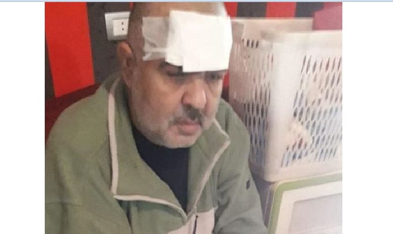 إصابة لاجئ في مخيم برج البراجنة اثر سقوط أجزاء من سقف منزله