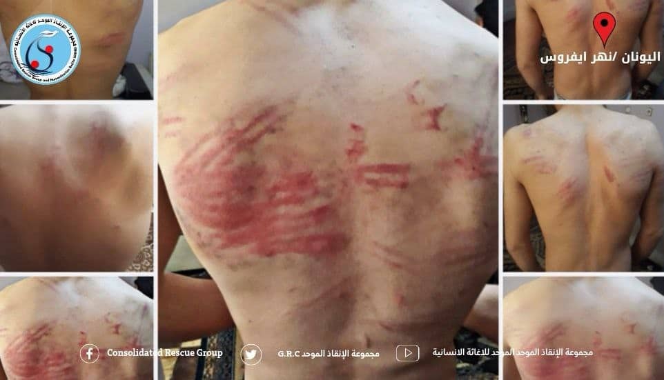 " جعلوني آكل التراب" تفاصيل مروعة عن انتهاكات حرس الحدود اليوناني بحق اللاجئين