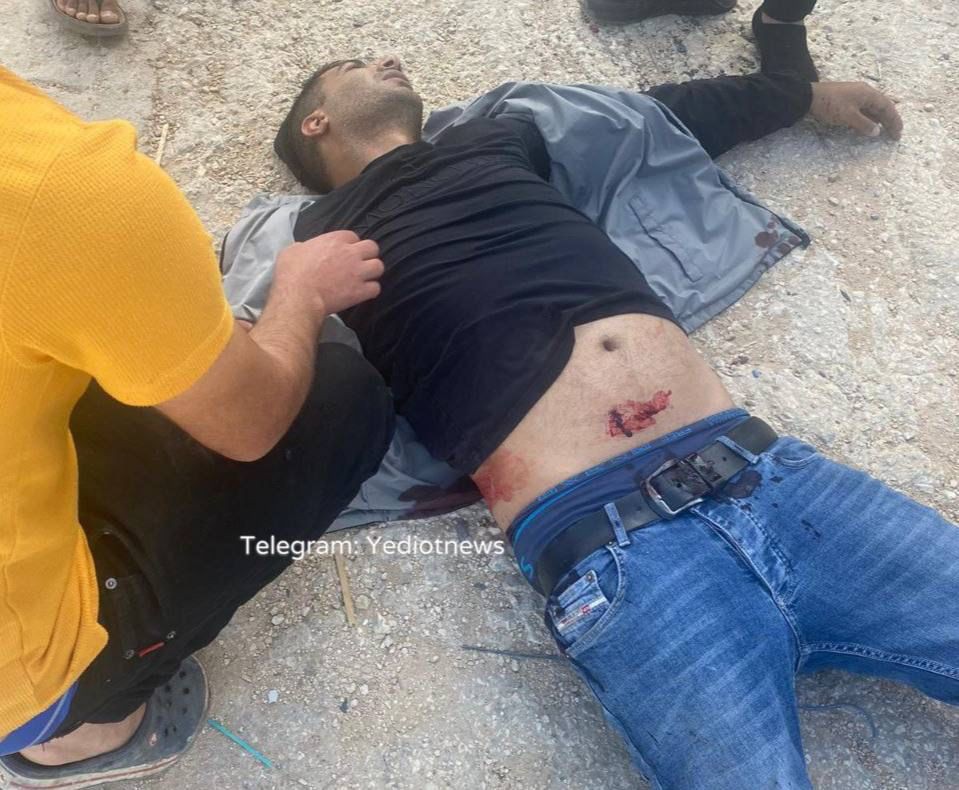 تدهور صحة الجريح داوود زبيدي ونقله لمشفى في حيفا