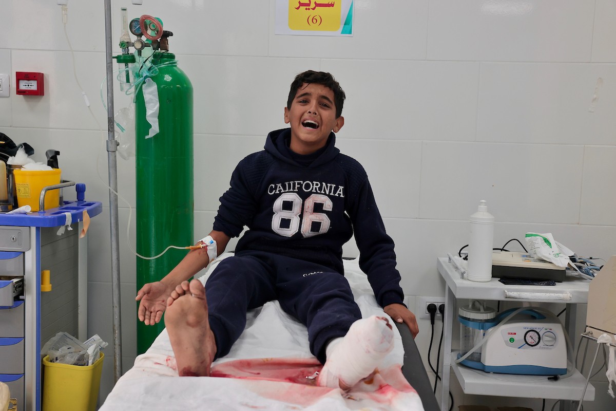أكثر من ألف طفل في قطاع غزة تعرضوا لبتر ساق جراء القصف "الإسرائيلي"