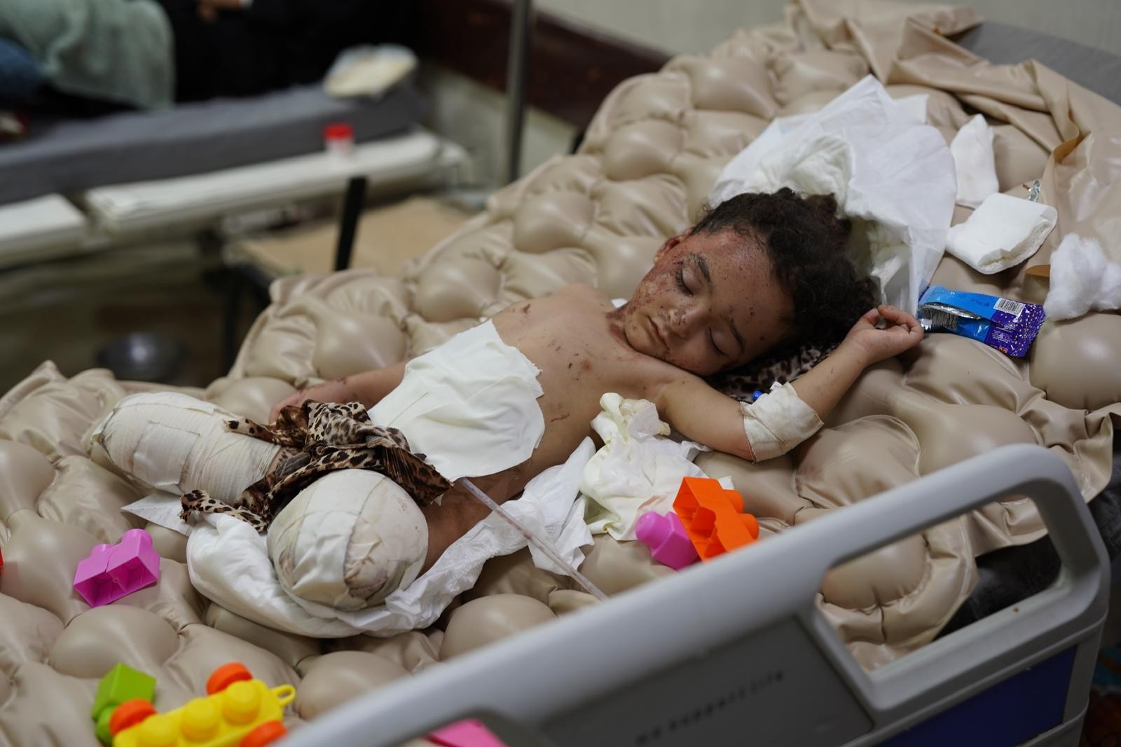 حين لا يحمي التطعيم أطفال غزة من الصواريخ "الإسرائيلية".. هذا ما حلّ بحنان ومسك