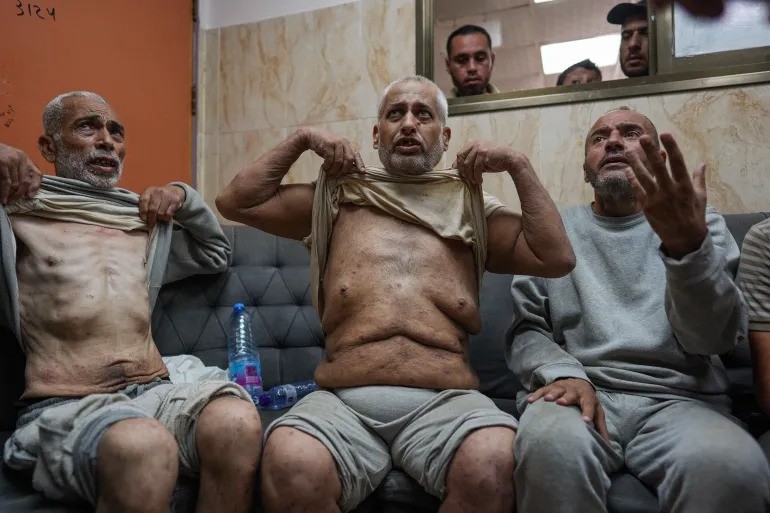 هيئة شؤون الأسرى تحذر من انتشار الأمراض الجلدية في معتقلي "جلبوع" و"عوفر"