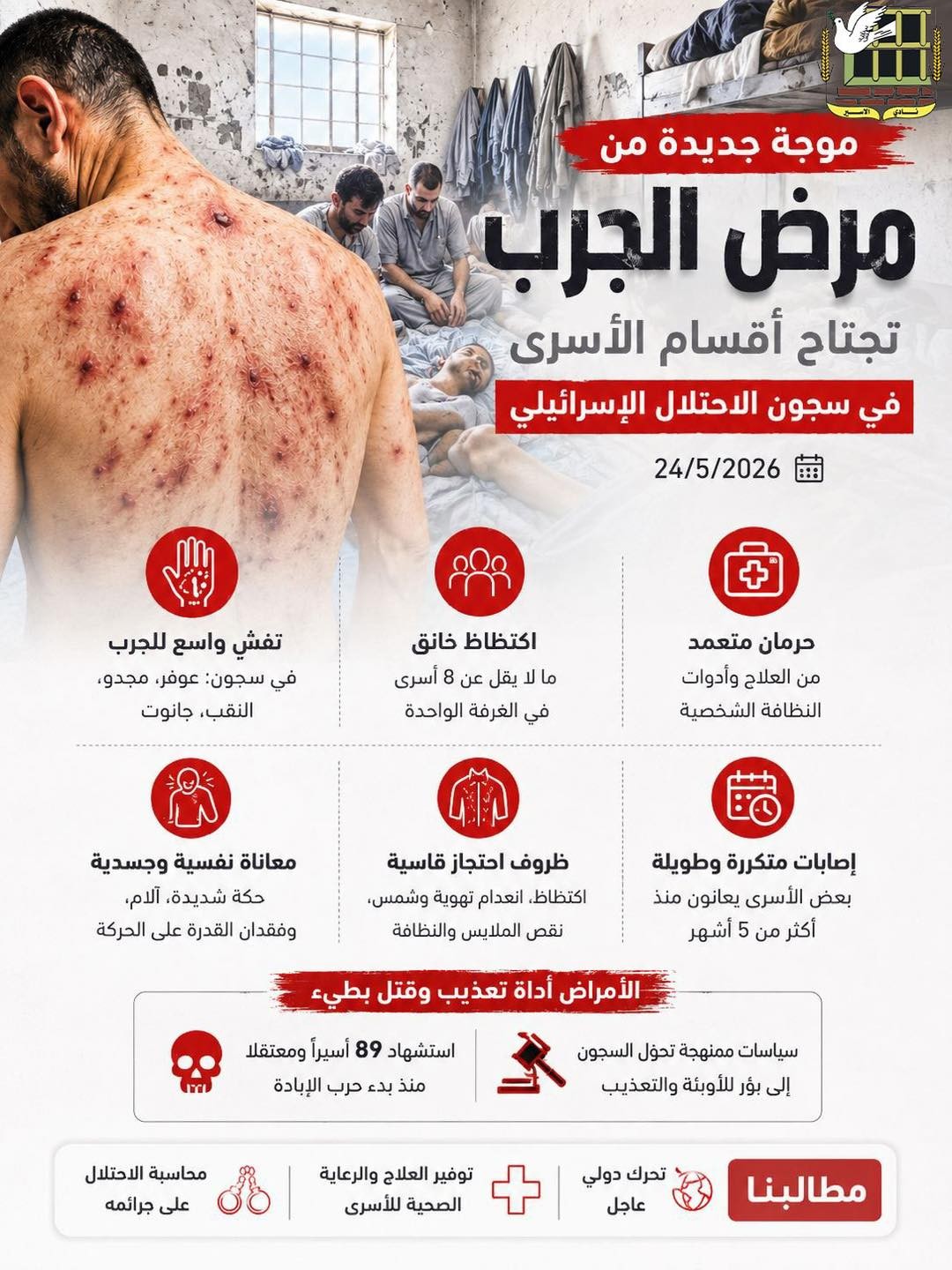 نادي الأسير: موجة خطيرة من الجرب تجتاح أقسام الأسرى في سجون الاحتلال